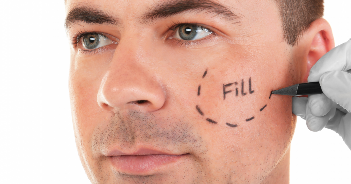 Male_Facelift