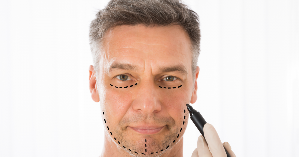 Male_Facelift_copy