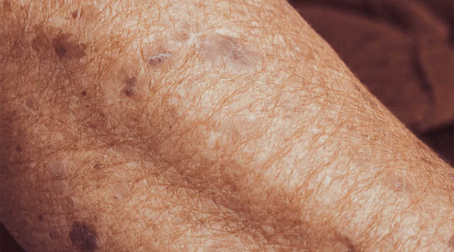 amspa-aging-skin-103025