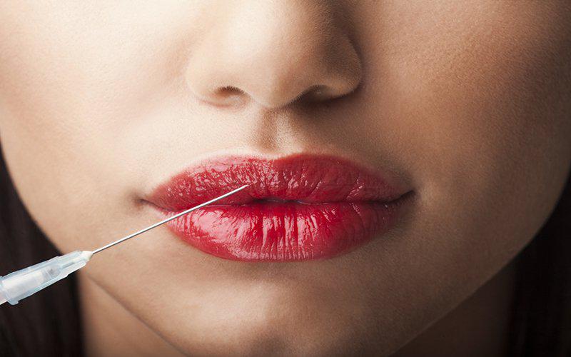 botoxlips