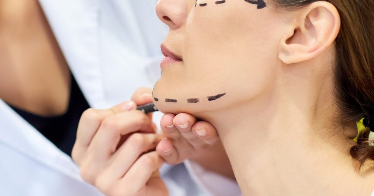 face-lift