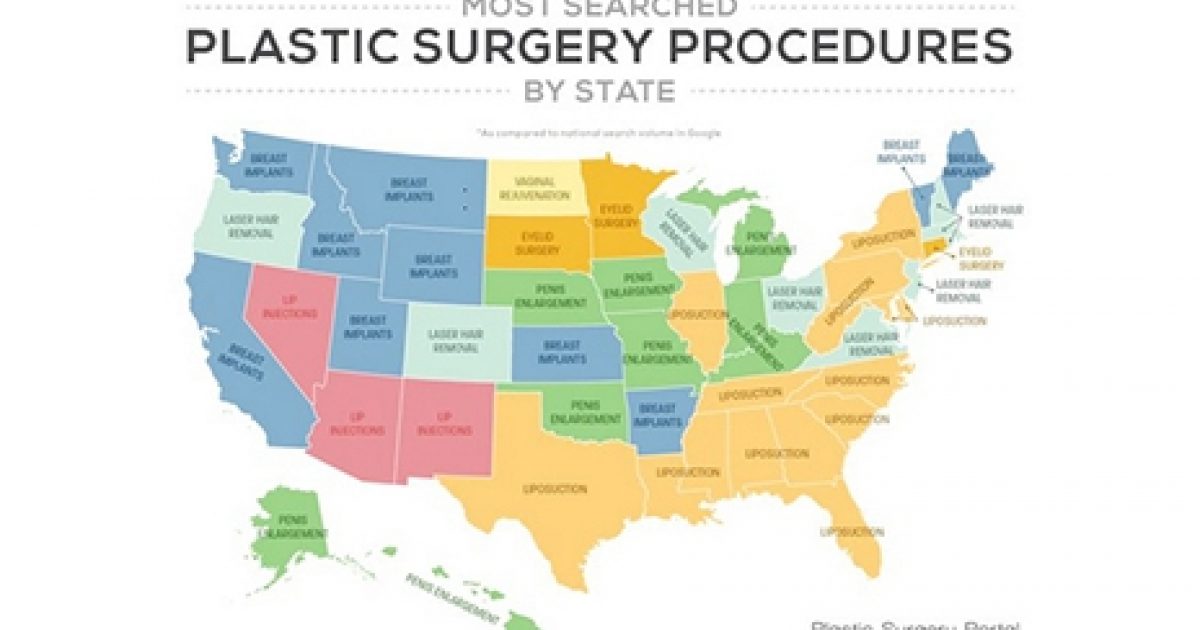 infographic