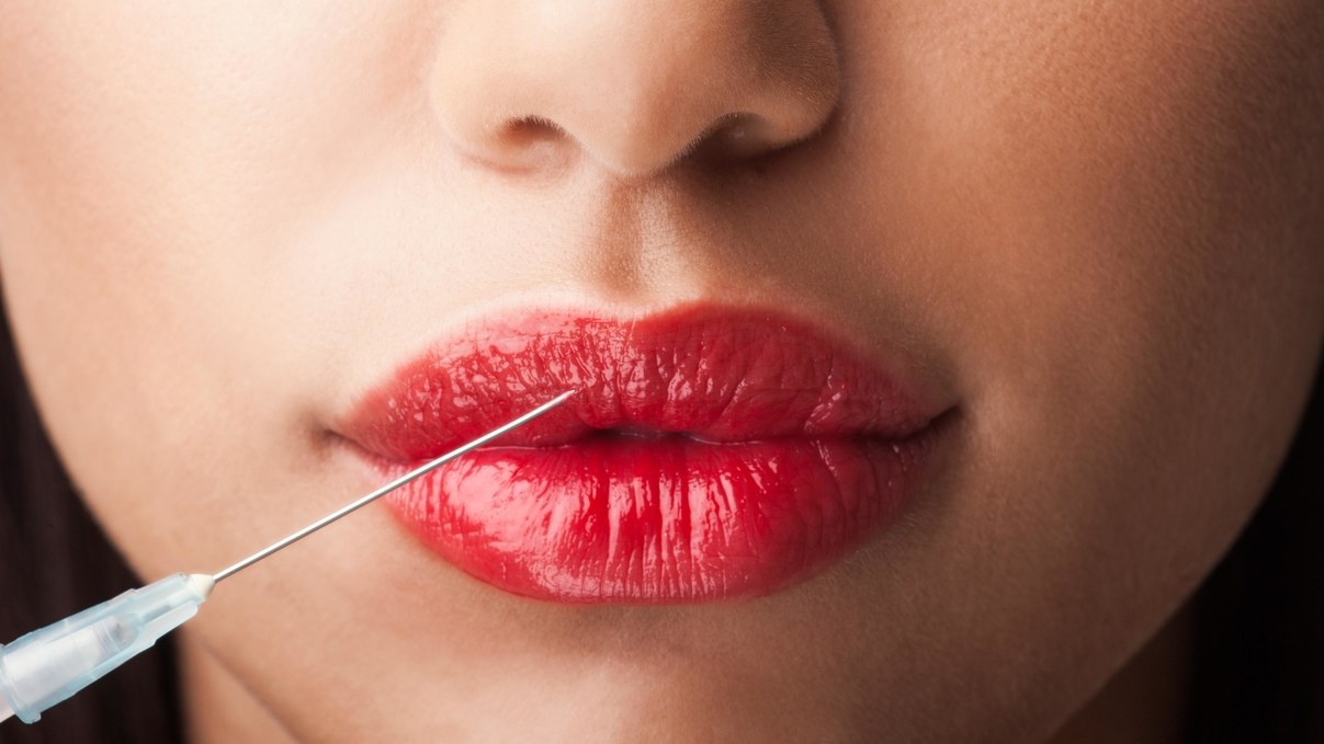 lip-injections