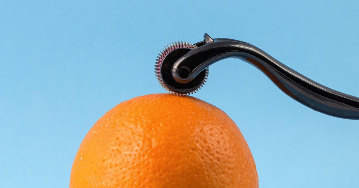 microneedling-legal-tips